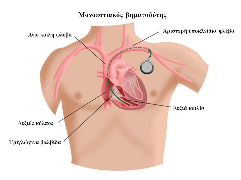 sc-ppm image